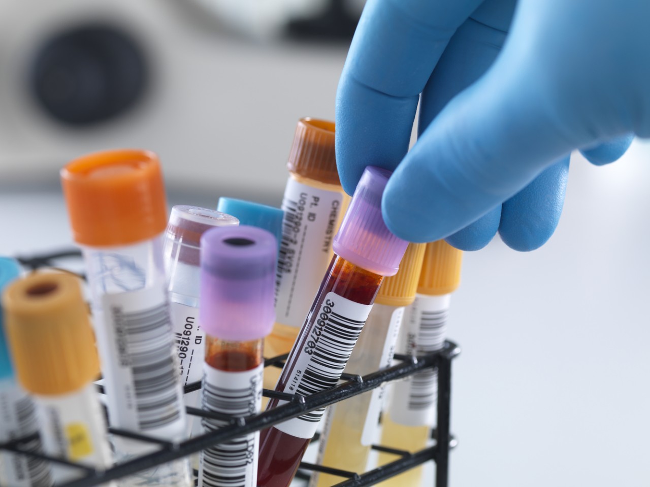 “溶出”还是“BE”，何为临床疗效“金标准”