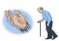 帕金森。芭痢辈慌？