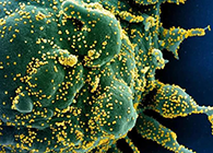 唾液检测新冠抗体新方法来了，获取结果仅需几小时！