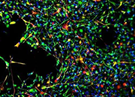 世界首创：药物将干细胞引导至受损部位，提高其愈合能力！