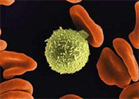 Science子刊：一种FDA批准的抗腹泻药物可有效对抗化疗的耐药性