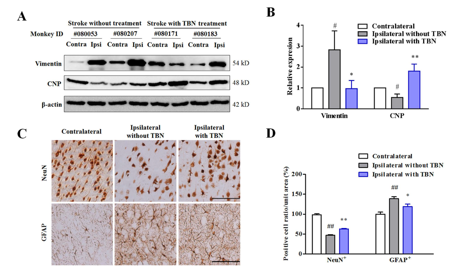 TBN是一种治疗缺血性卒中的新型临床候选药物，本研究中TBN通过不朽情缘mg官网合成